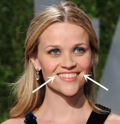 窄额头短下巴明星,揭秘他们的独特魅力